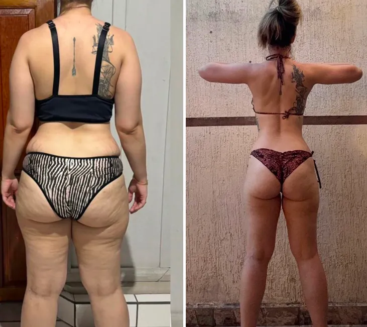 Antes e depois de aluno do protocolo