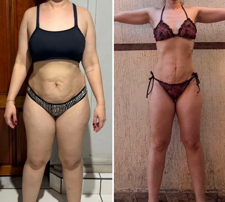 Antes e depois de aluno do protocolo