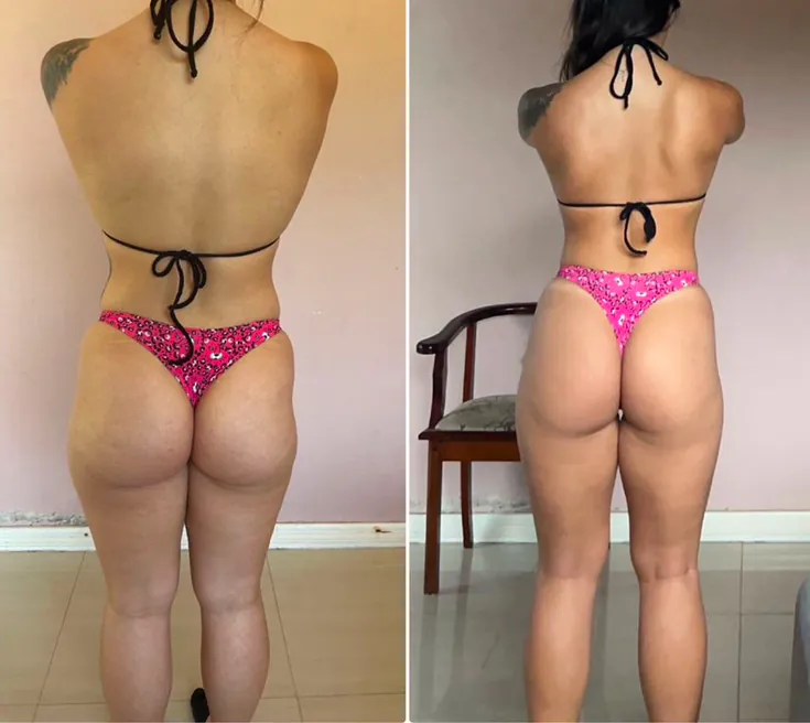 Antes e depois de aluno do protocolo